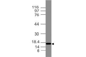 Image no. 1 for anti-Developmental Pluripotency Associated 3 Pseudogene 2 (DPPA3P2) antibody (ABIN5027789) (STELLAR anticorps)