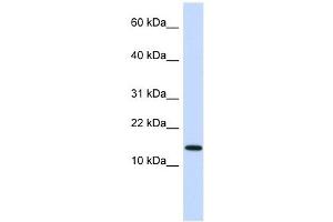 Western Blot showing NME1 antibody used at a concentration of 1 ug/ml against Fetal Heart Lysate (NME1 anticorps  (N-Term))