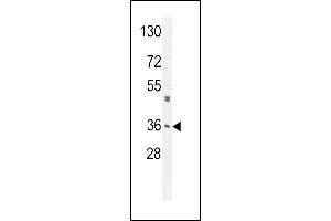M6PR Antibody (C-term) (ABIN650726 and ABIN2839414) western blot analysis in A549 cell line lysates (35 μg/lane). (M6PR anticorps  (C-Term))