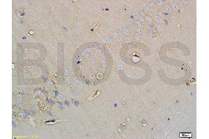 Formalin-fixed and paraffin embedded rat brain tissue labeled with Anti-SGLT1 Polyclonal Antibody, Unconjugated (ABIN738066) at 1:200 followed by conjugation to the secondary antibody and DAB staining