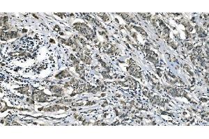 IHC analysis of Carbonic Anhydrase I/CA1 using anti-Carbonic Anhydrase I/CA1 antibody (ABIN7602621). (CA1 anticorps  (AA 9-261))