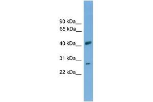 WB Suggested Anti-SLC25A37 Antibody Titration: 0. (SLC25A37 anticorps  (Middle Region))