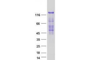 Validation with Western Blot