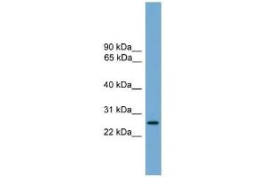 LRRC3 antibody used at 1 ug/ml to detect target protein. (LRRC3 anticorps  (Middle Region))