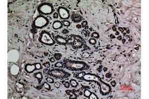 Immunohistochemistry (IHC) analysis of paraffin-embedded Human Breast, antibody was diluted at 1:100. (HMGB1 anticorps  (acLys12))