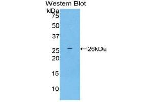Detection of Recombinant CASP11, Mouse using Polyclonal Antibody to Protein SCAF11 (SCAF11)