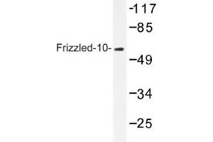 Image no. 1 for anti-Frizzled Family Receptor 10 (FZD10) antibody (ABIN317639) (FZD10 anticorps)
