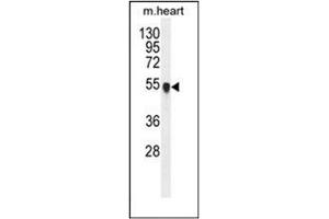 Western blot analysis of PPM1L Antibody (C-term) in mouse heart tissue lysates (35ug/lane).