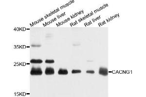 Western blot analysis of extracts of various cells, using CACNG1 antibody. (CACNG1 anticorps)