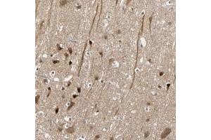 Immunohistochemical staining of human cerebral cortex with HECW1 polyclonal antibody  shows strong nuclear and cytoplasmic positivity in neuronal cells at 1:10-1:20 dilution.