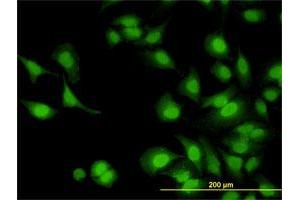 Immunofluorescence of monoclonal antibody to IRAK1 on HeLa cell. (IRAK1 anticorps  (AA 530-693))