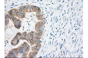 Immunohistochemistry (IHC) image for anti-Eukaryotic Translation Initiation Factor 2 Subunit 1 (EIF2S1) antibody (ABIN1497972)