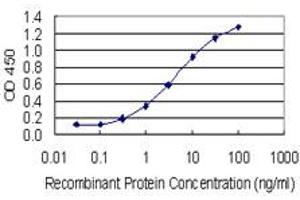 Detection limit for recombinant GST tagged AKR1C1 is 0.