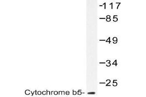Western blot (WB) analysis of Cytochrome b5 antibody in extracts from A549 cells. (CYB5R3 anticorps)