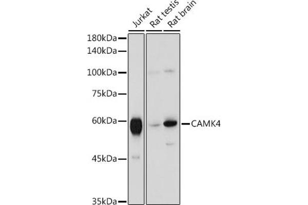 CAMK4 anticorps  (AA 304-473)