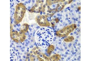 Immunohistochemistry of paraffin-embedded Mouse kidney using KRT19 Polyclonal Antibody at dilution of 1:100 (40x lens).