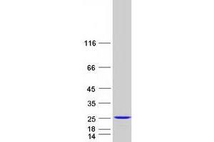 Validation with Western Blot
