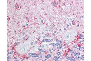 Anti-KAL1 / Anosmin antibody IHC of human brain, cerebellum.