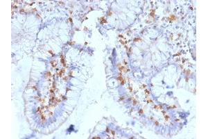 Formalin-fixed, paraffin-embedded human Small Intestine stained with CD103 Mouse Monoclonal Antibody (ITGAE/2063).