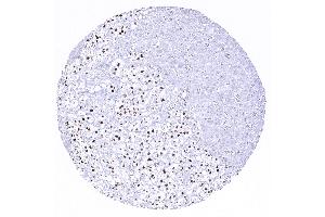 Strong INSM1 immunostaining of medullar but not cortical cells of the adrenal gland