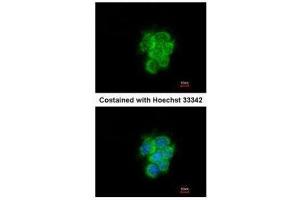 ICC/IF Image Immunofluorescence analysis of methanol-fixed A431, using MIPEP, antibody at 1:200 dilution. (MIPEP anticorps)