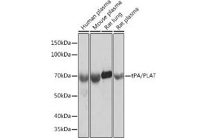 Western blot analysis of extracts of various cell lines, using tPA/tPA/PLAT Rabbit mAb (ABIN1678727, ABIN3018699, ABIN3018700 and ABIN7101650) at 1:1000 dilution. (PLAT anticorps)
