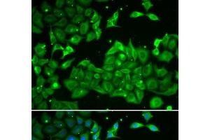 Immunofluorescence analysis of HeLa cells using ALDH3A1 Polyclonal Antibody