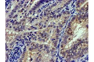 Image no. 1 for anti-Calpain 9 (CAPN9) antibody (ABIN1497090) (Calpain 9 anticorps)