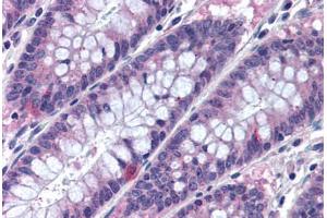 Human Colon (formalin-fixed, paraffin-embedded) stained with MTSS1 antibody ABIN290367 at 10 ug/ml followed by biotinylated goat anti-rabbit IgG secondary antibody ABIN481713, alkaline phosphatase-streptavidin and chromogen. (MTSS1 anticorps  (AA 670-720))
