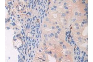 Detection of MYL3 in Mouse Oviduct Tissue using Polyclonal Antibody to Myosin Light Chain 3, Alkali, Ventricular, Slow Skeletal (MYL3) (MYL3/CMLC1 anticorps  (AA 8-199))