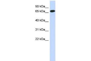 WB Suggested Anti-C1orf65 Antibody Titration: 0. (C1orf65 anticorps  (N-Term))