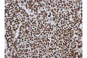 IHC-P Image Immunohistochemical analysis of paraffin-embedded 59T xenograft, using HMGB1, antibody at 1:500 dilution. (HMGB1 anticorps)