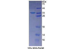 SDS-PAGE analysis of Human SLFN5 Protein. (SLFN5 Protéine)