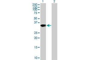 Western Blot analysis of ARL10 expression in transfected 293T cell line by ARL10 MaxPab polyclonal antibody. (ARL10 anticorps  (AA 1-276))