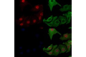 ABIN6262189 and ABIN6266560 staining Hela cells by IF/ICC. (HDAC7 anticorps  (Internal Region))