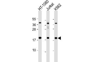 All lanes : Anti-NAT13 Antibody (C-term) at 1:1000 dilution Lane 1: HT-1080 whole cell lysate Lane 2: Jurkat whole cell lysate Lane 3: K562 whole cell lysate Lysates/proteins at 20 μg per lane. (NAA50 anticorps  (C-Term))