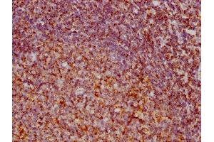 IHC image of ABIN7127868 diluted at 1:73.