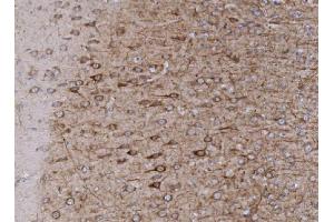 IHC analysis of Integrin beta 4/ITGB4 using anti-Integrin beta 4/ITGB4 antibody (ABIN7600912).