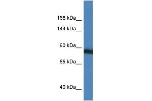 WB Suggested Anti-SEMA4D Antibody Titration: 1. (SEMA4D/CD100 anticorps  (N-Term))