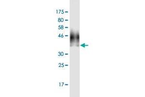 Western Blot detection against Immunogen (39. (RPS2 anticorps  (AA 47-170))
