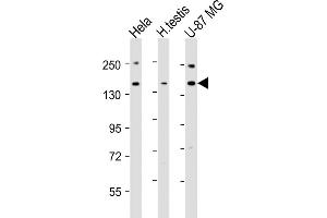 All lanes : Anti-USP47 Antibody (Center) at 1:2000 dilution Lane 1: Hela whole cell lysates Lane 2: human testis lysates Lane 3: U-87 MG whole cell lysates Lysates/proteins at 20 μg per lane. (USP47 anticorps  (AA 588-620))