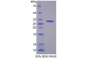 SDS-PAGE (SDS) image for alpha-2-Macroglobulin (A2M) (AA 157-389) protein (His tag) (ABIN1877409)