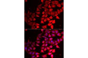 Immunofluorescence analysis of MCF7 cells using CMPK1 antibody.