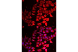 Immunofluorescence analysis of MCF7 cells using CMPK1 antibody. (Cytidine Monophosphate (UMP-CMP) Kinase 1, Cytosolic (CMPK1) (AA 69-228) anticorps)