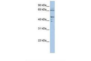 Image no. 1 for anti-Dihydrolipoyl Transacetylase (DLAT) (AA 540-589) antibody (ABIN6738015) (DLAT anticorps  (AA 540-589))