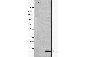 Western blot analysis of A375  lysate using S100B antibody. (S100B anticorps  (C-Term))