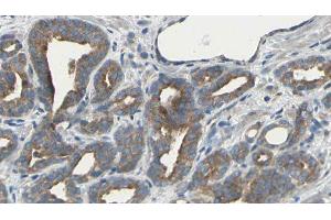 ABIN6275494 at 1/100 staining Human prostate tissue by IHC-P. (ARHGEF10 anticorps  (Internal Region))