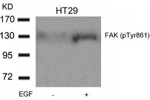 Western blot analysis of extracts from HT29 cells untreated or treated with EGF using FAK(Phospho-Tyr861) Antibody. (FAK anticorps  (pTyr861))