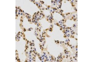 Immunohistochemistry of paraffin-embedded rat lung using DiMethyl-Histone H3-K36 antibody.