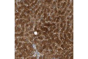 Immunohistochemical staining of human liver with PARP14 polyclonal antibody  shows strong cytoplasmic positivity in hepatocytes at 1:50-1:200 dilution. (PARP14 anticorps)